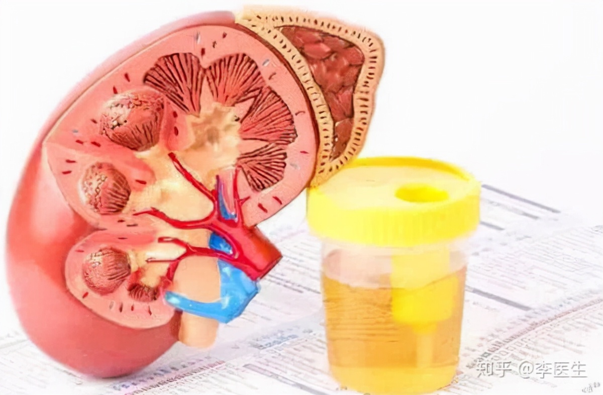 肾病用中医会伤肾吗,女人肾病怎么治