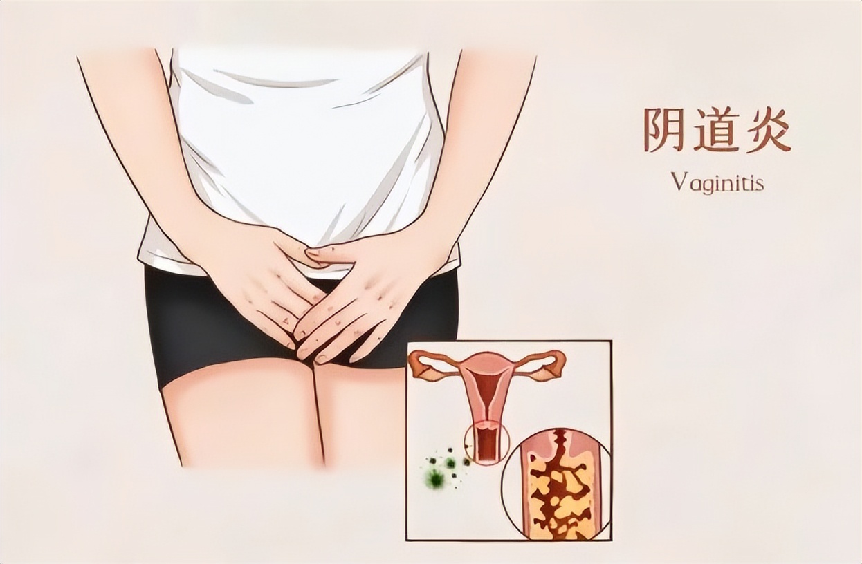 夫妻同房后，女性身体出现这3个症状，要注意了！