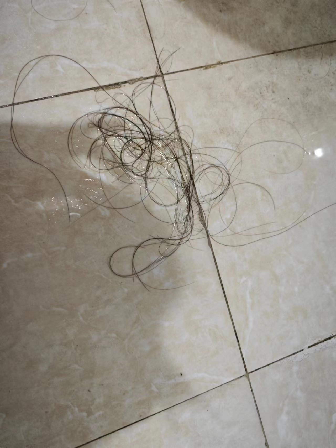 用米诺地尔两个星期疯狂掉头发 (使用米诺地尔期间掉头发更多了)