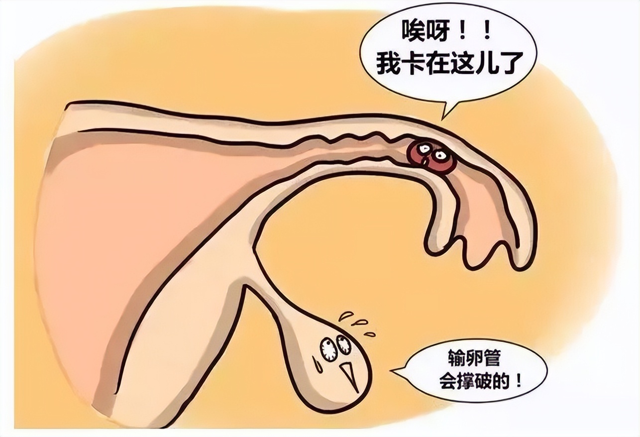 不是痛经而是不舒服,不是引发痛经的原因