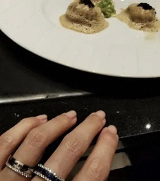 “小丑手”太减分了，这8位女星个个貌美如花，却被手拖后腿