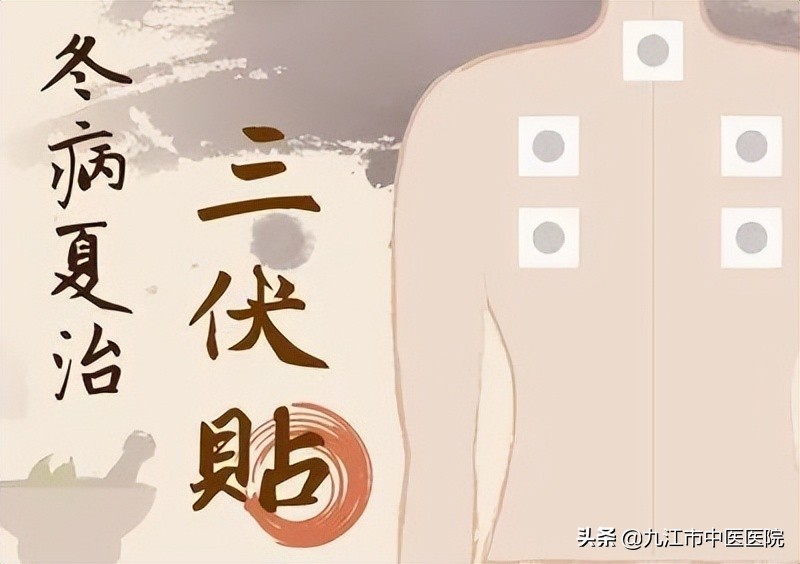 冬病夏治三伏贴药物配方,冬病夏治的三伏贴怎么样