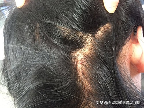 金紫雨植物养发护发素,金紫雨养发馆加盟费多少