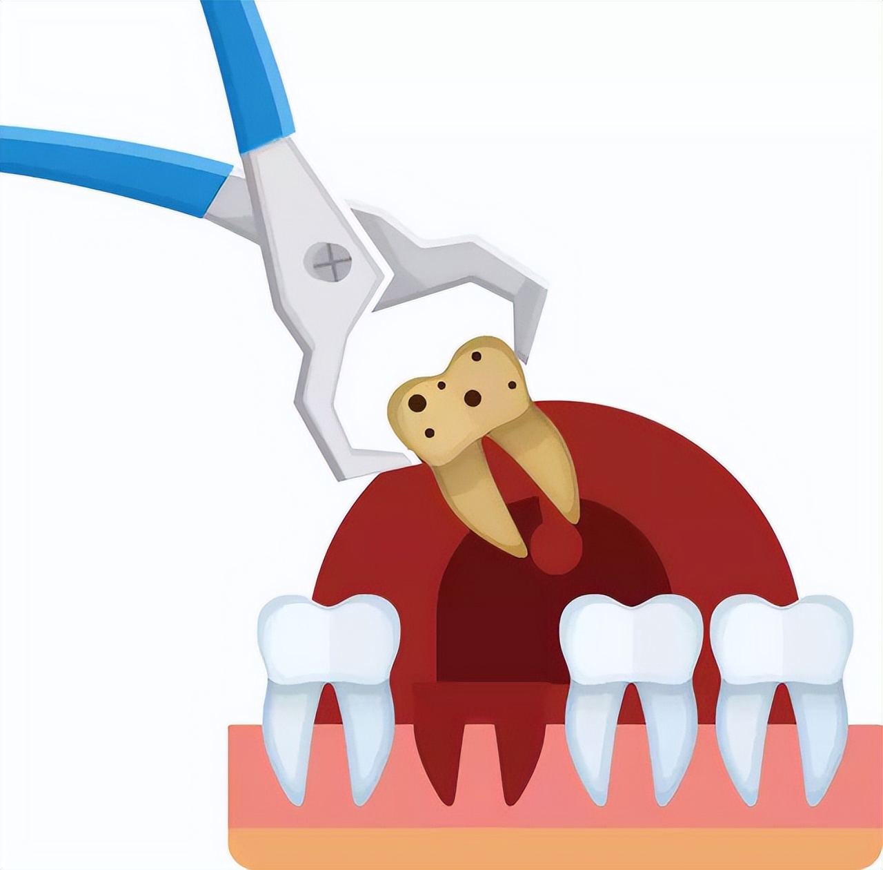 拔牙会很痛吗不敢去拔牙,不敢拔牙怎么办