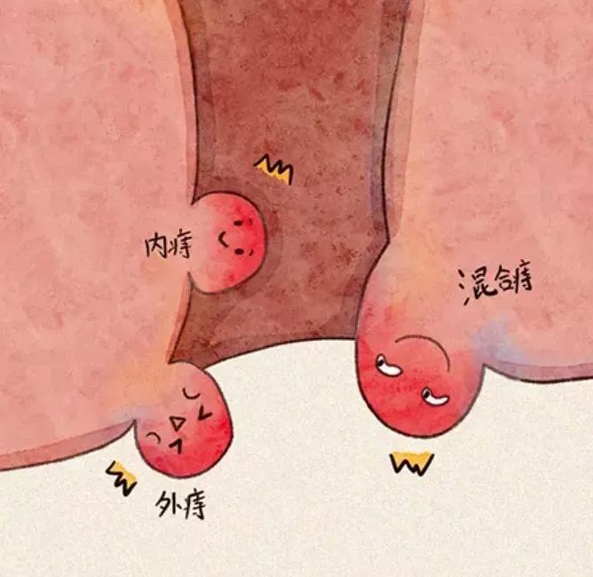 提肛有什么好处,健身操提肛好处