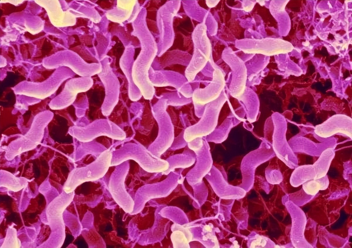 革兰氏阳性孢子,革兰氏阳性孢子菌