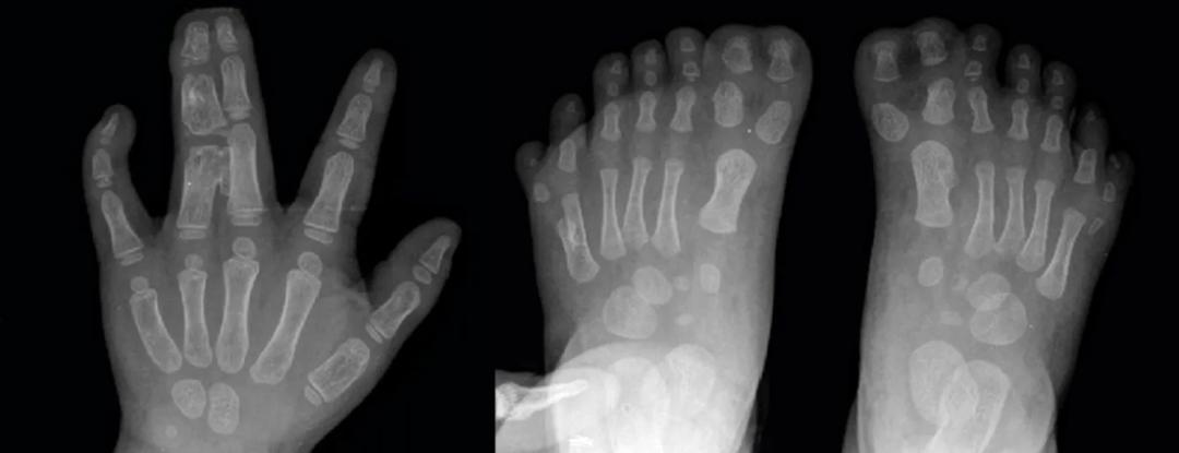 *亲近**繁殖危害很大！这是来自基因的“诅咒”，无法破解