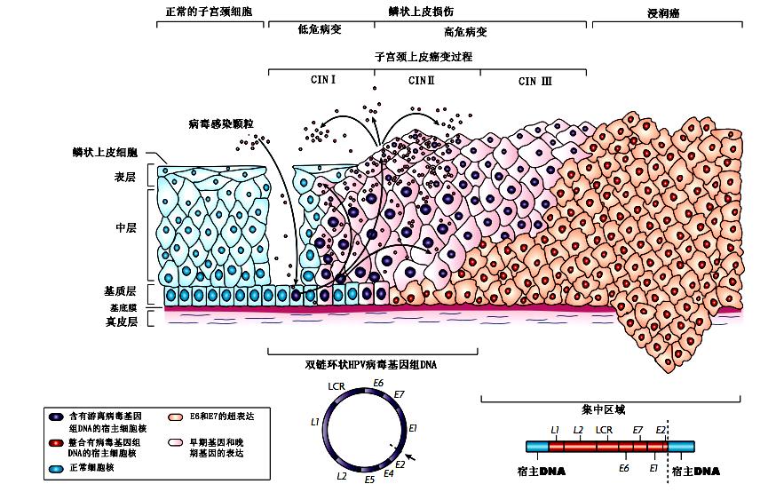 专家精选｜HPV持续感染干预的思考