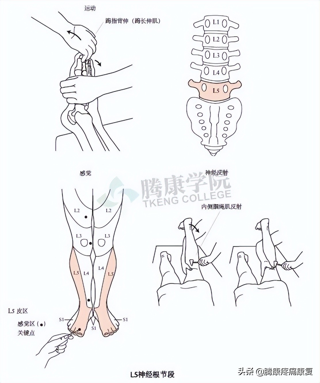 腰骶丛神经检查痛苦吗,腰骶椎不舒服怎样检查