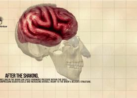 奶爸哄娃失手把孩子摔成重度脑伤,哄娃失手摔成脑损伤后续怎么样了