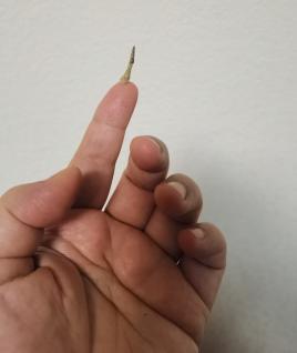 黄贵生灸关元,黄贵生谈灸关元