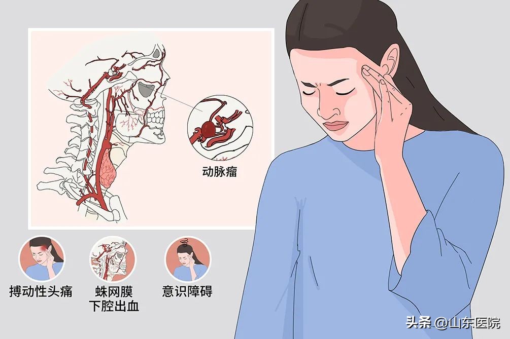 大学城医院神经外科再创奇迹成功拆除患者颅内“定时*弹炸**”