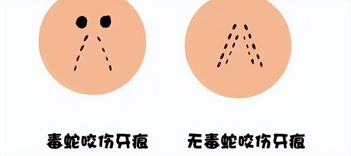 有蛇出没多地居民区如何防蛇,蛇出没最全防蛇手册来了