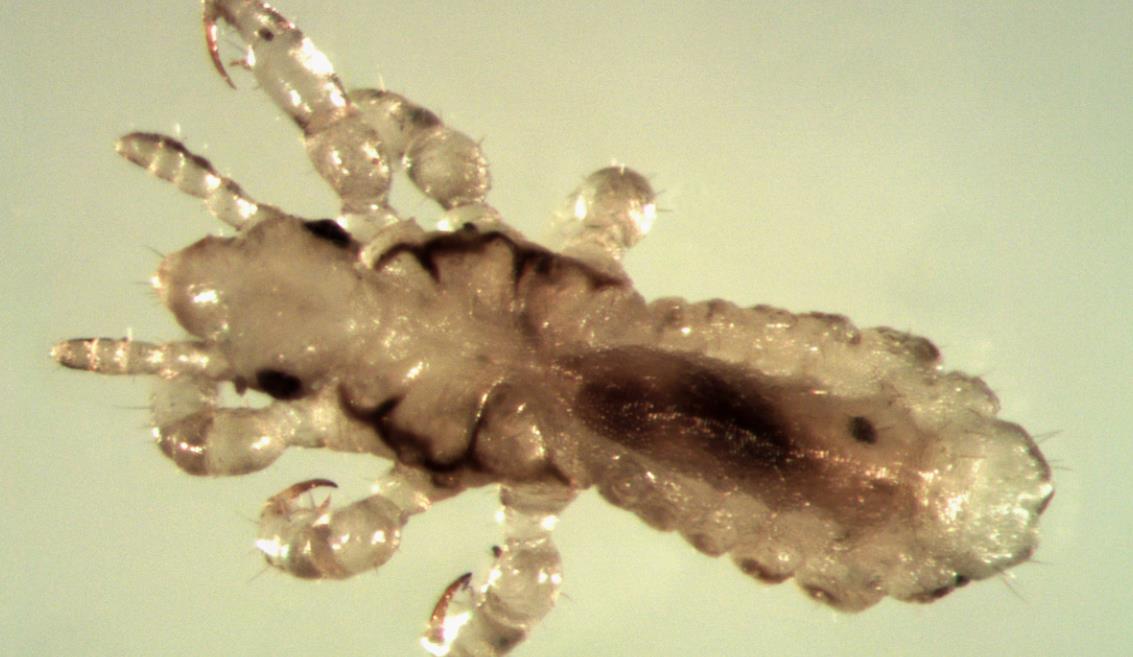 阴虱病怕什么,阴虱可怕吗怎样才能处理干净