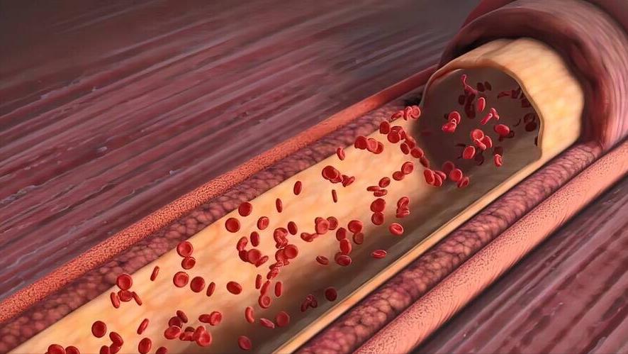 他汀类降血脂药哪种副作用最小,降血脂他汀好还是贝特类药好