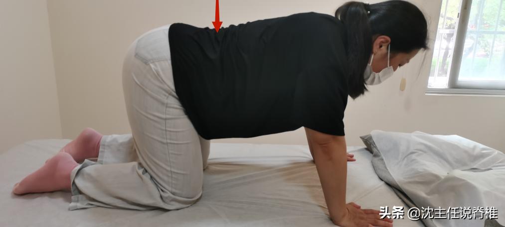 腰椎生理曲度变直锻炼能恢复吗,腰椎生理曲度变直还能恢复么