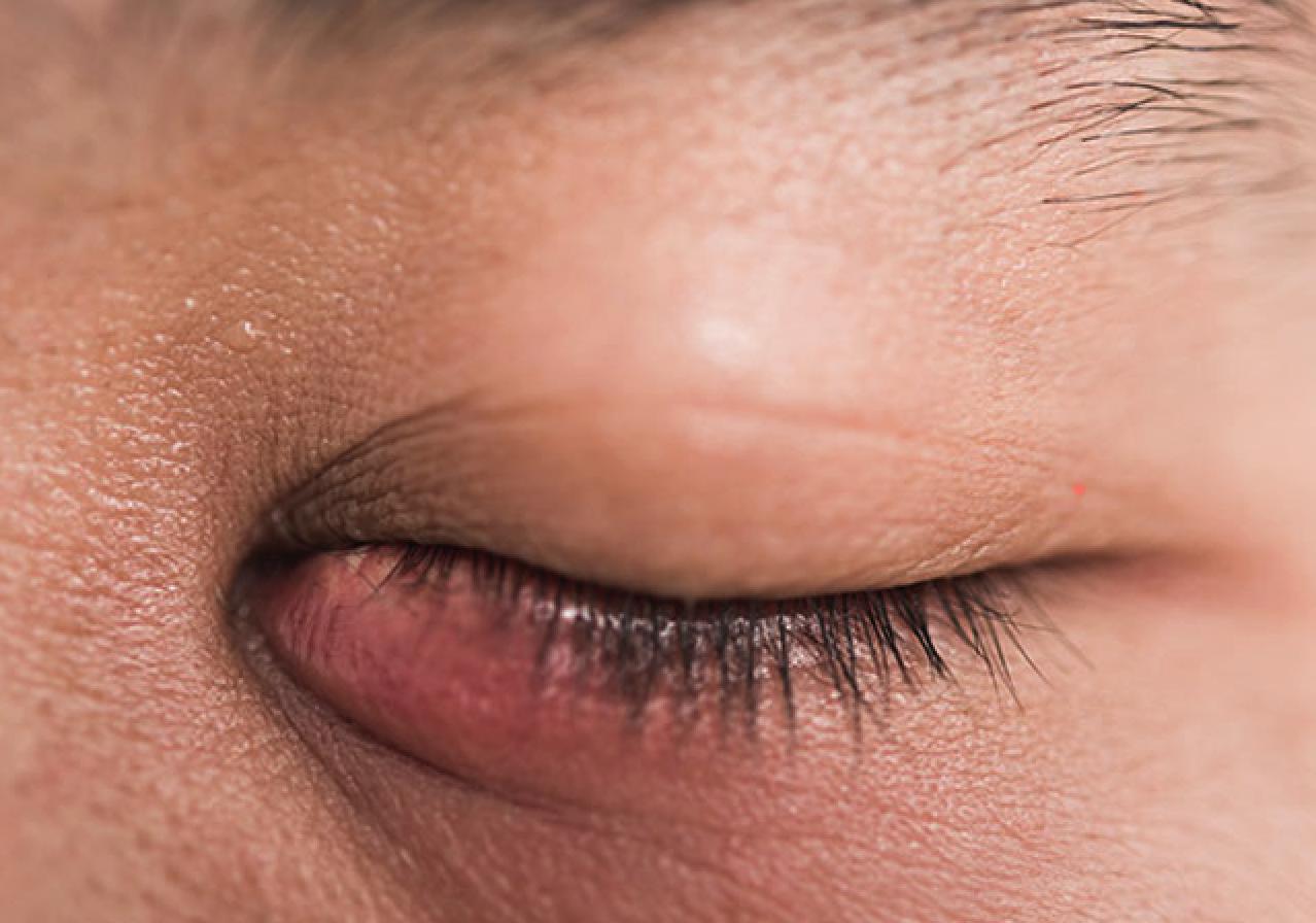 说文解字第661课,说文解字第551课