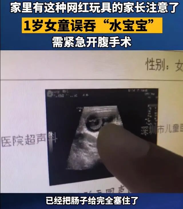 嘴咬胶带球，吞食水宝宝，网红玩具引发家长担忧：不是解压是危险