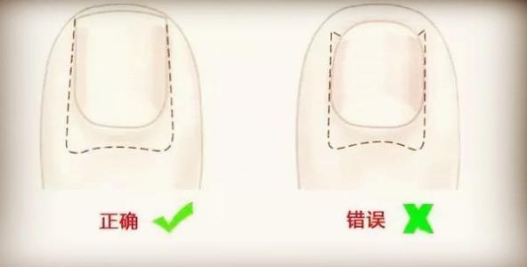 脚趾甲总往肉里长还疼是什么原因,脚趾甲老是戳到肉