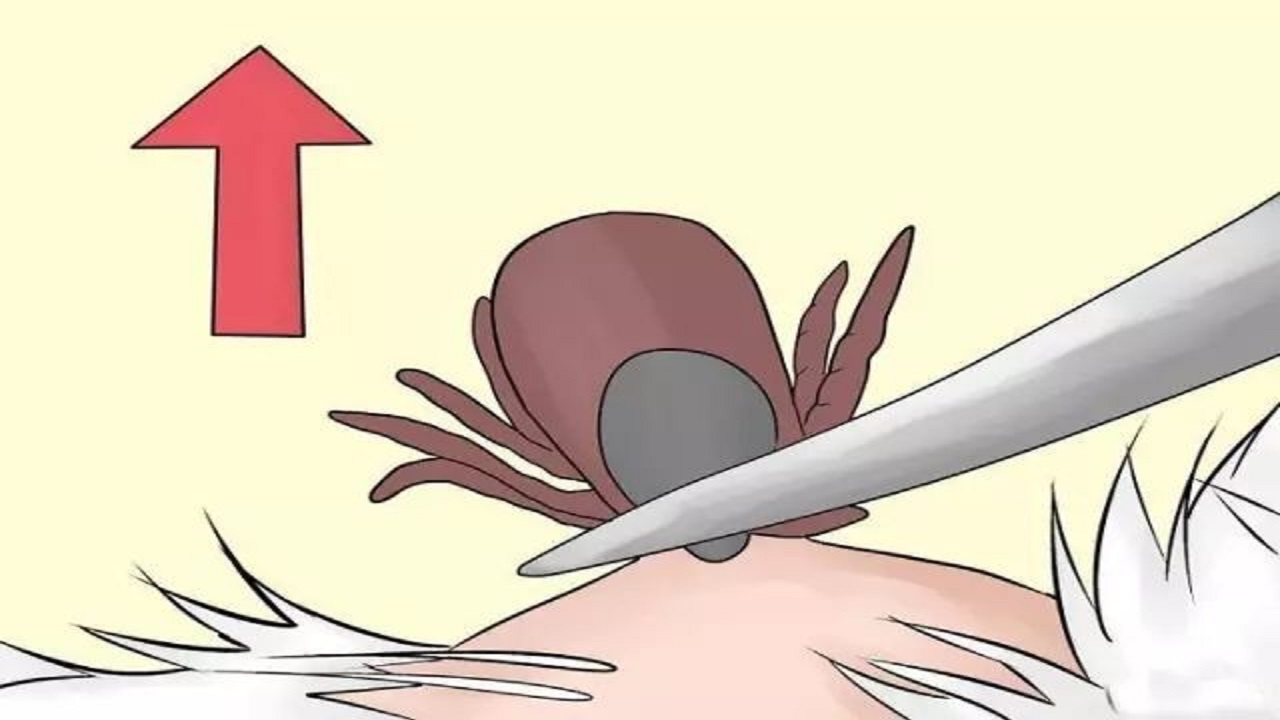 男性大量阴虱和虫卵,男子腹部痒