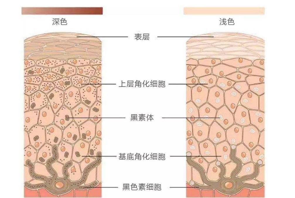 身上长这种颜色的痣要当心癌症,身上长痣怎么查是不是癌症