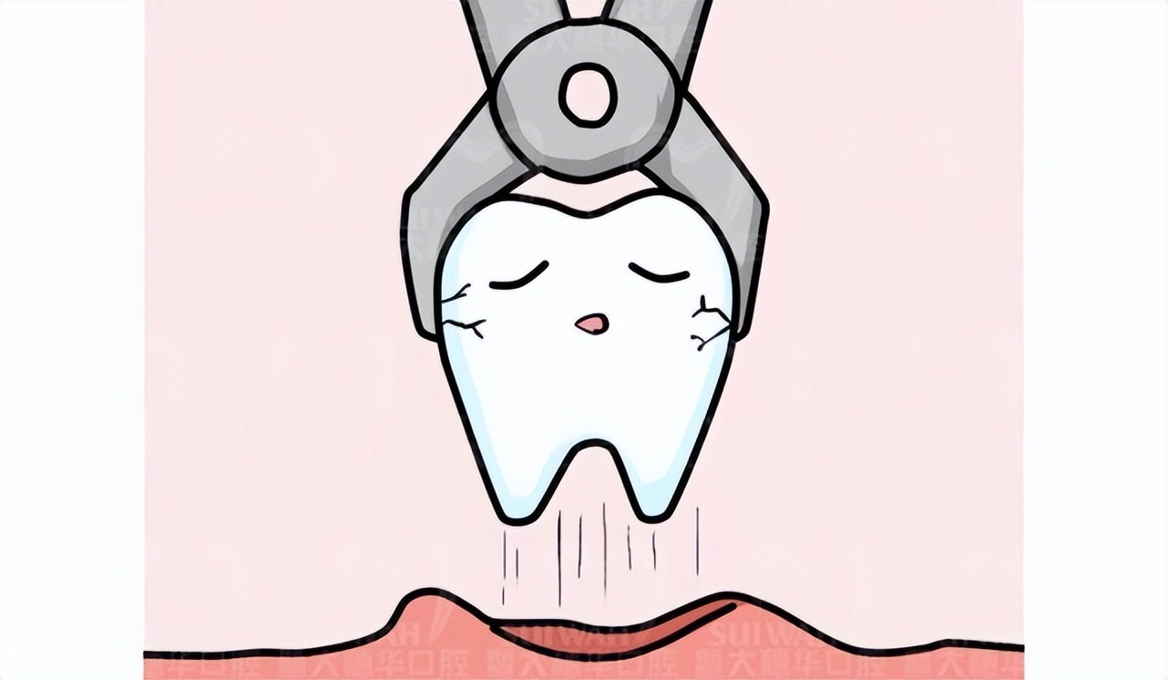 拔了智齿有个洞有食物残留怎么办,拔了智齿留了洞里面还出血正常吗