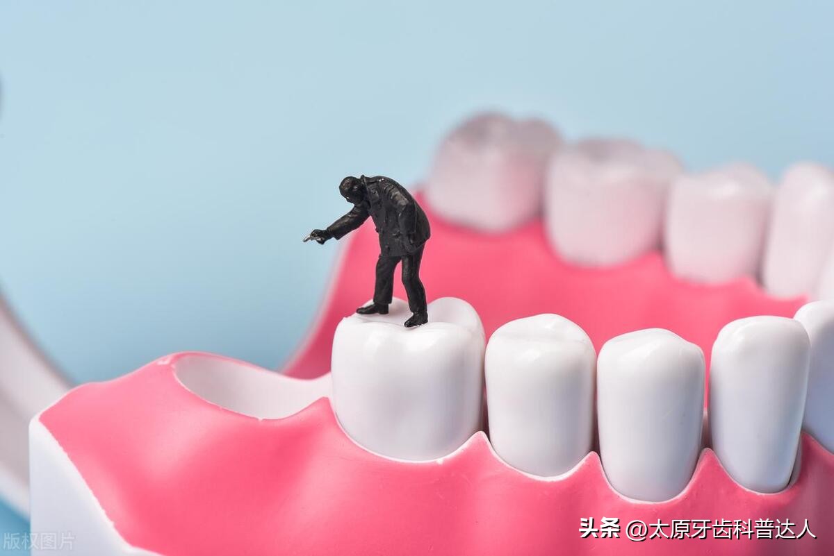 牙周病掉牙的罪魁祸首,老掉牙原来是牙周病作怪