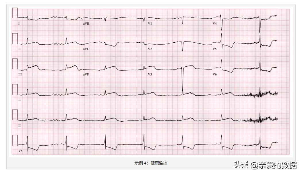 股票心电图走势说明什么,心电图股票走势分析