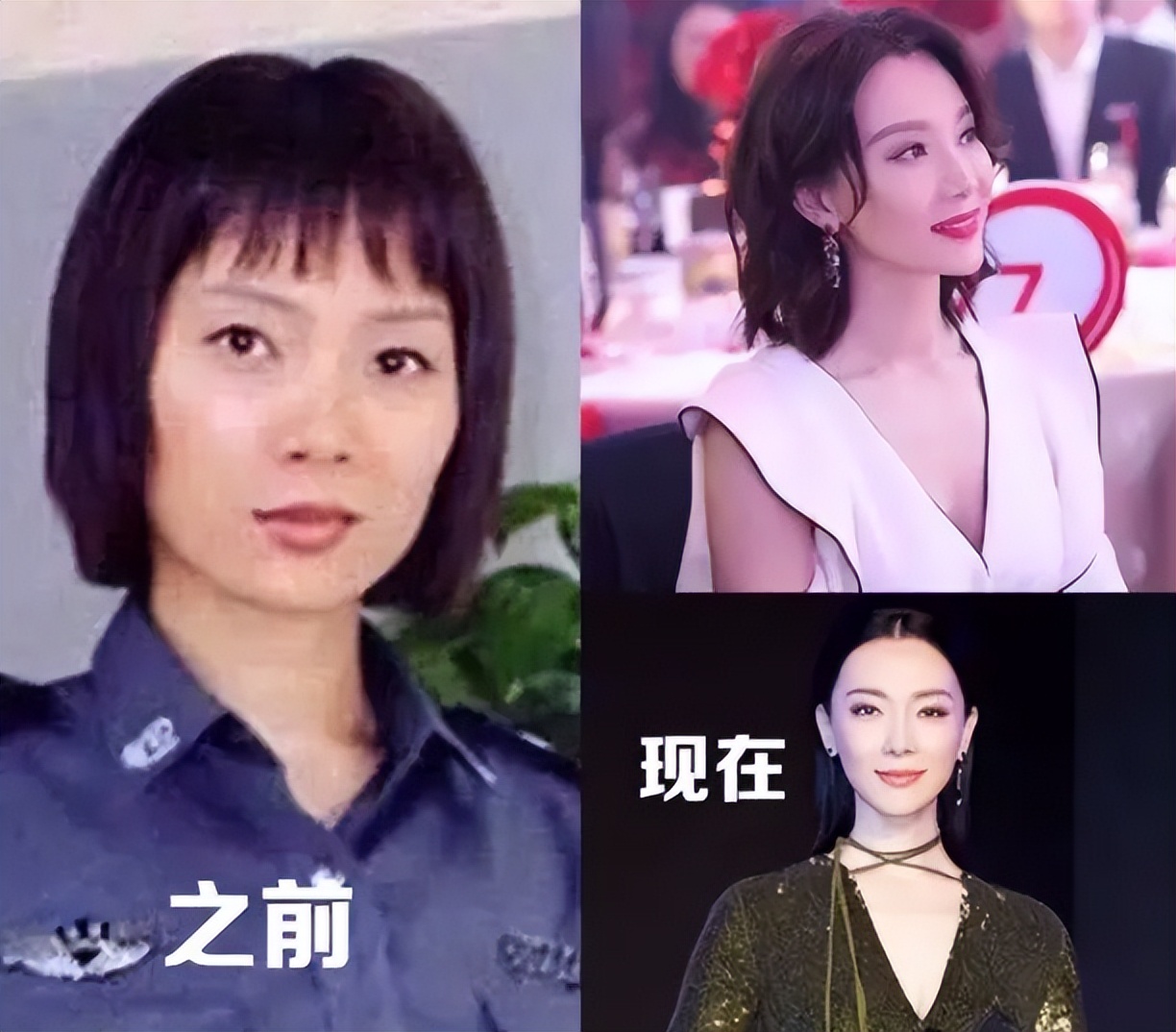 最近脸僵硬的女星,脸部变僵硬的女明星