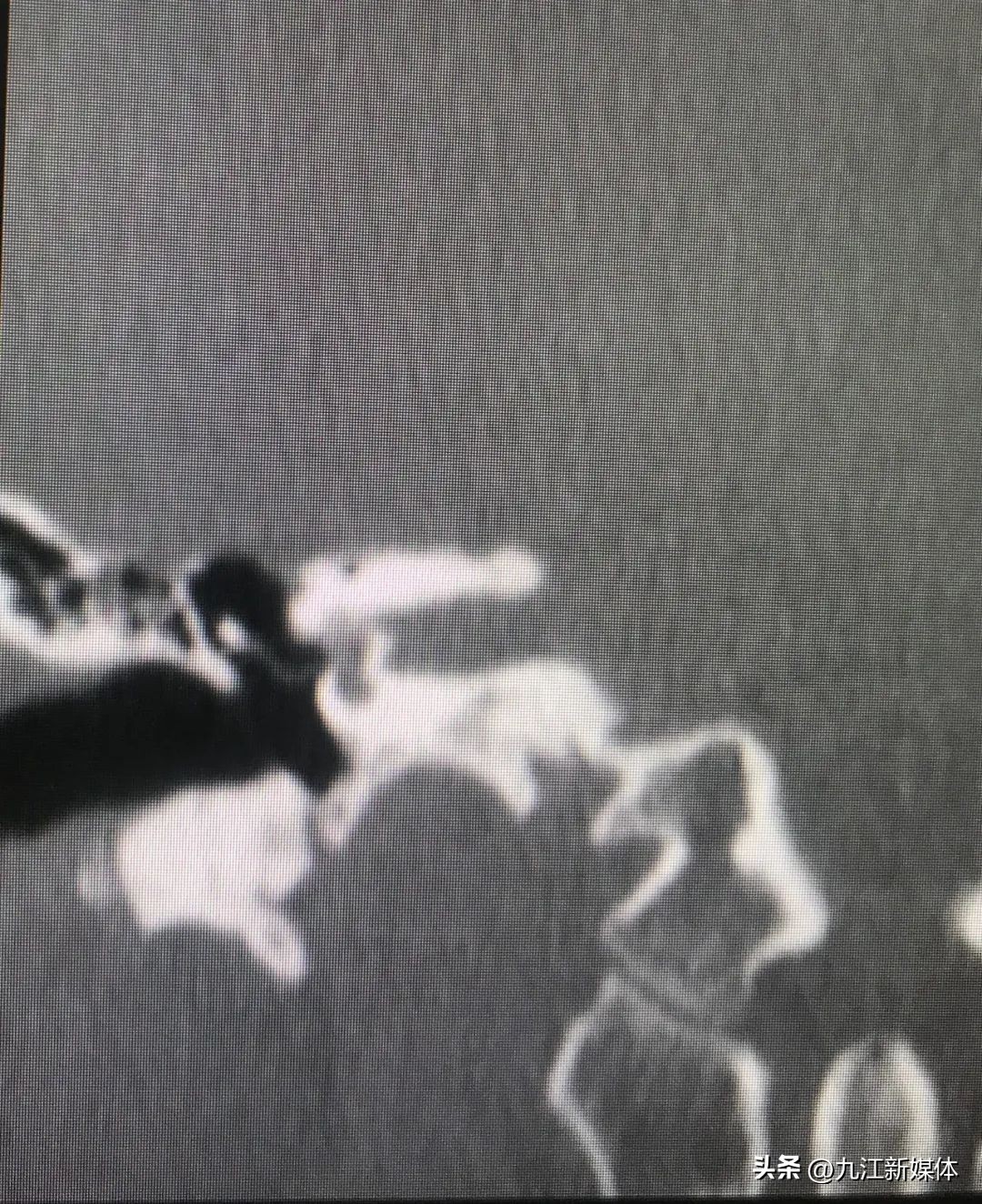 閲嶈幏鏂板0,閲嶈幏鏂扮敓闊抽