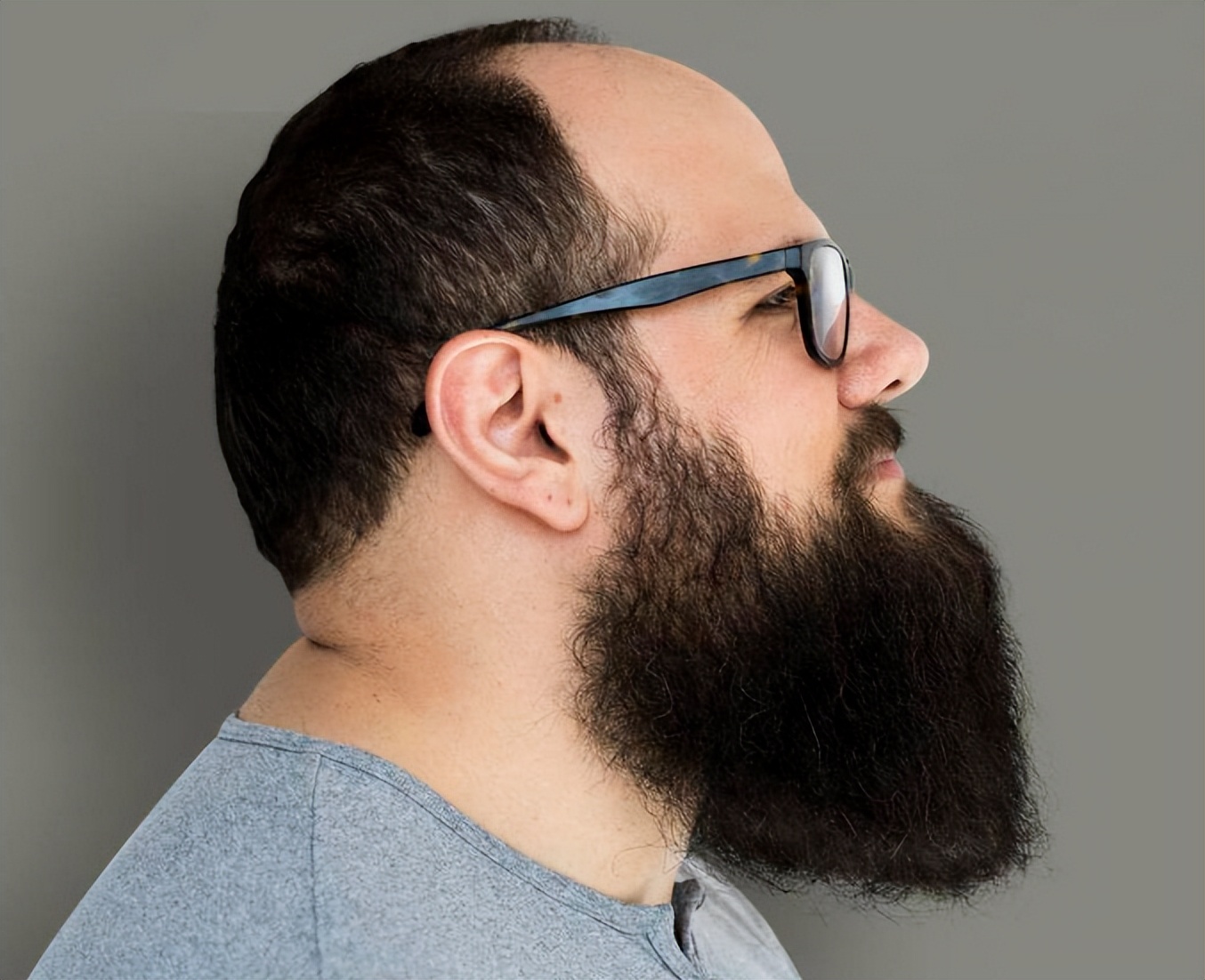 男人胡子长意味的什么,男人胡子长得快是什么病