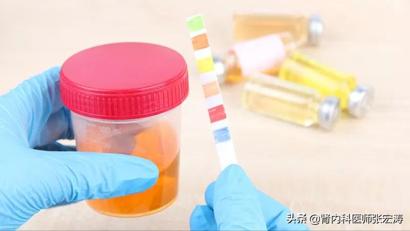 如何解读医学检验单之尿常规,尿常规检验报告单解读