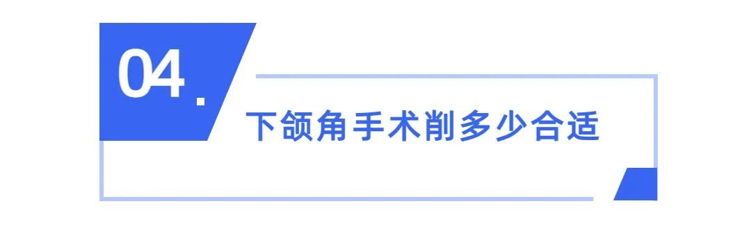 韦敏颧骨内推和削下颌角总费用,上海九院韦敏做下颌角价格