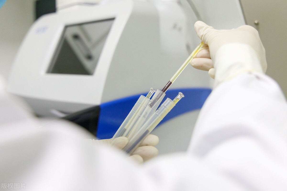 直肠癌的诱发因素,直肠癌诱发因素