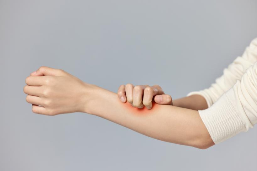 湿疹分为干性湿疹和湿性湿疹吗,湿疹反反复复到底是湿热还是湿寒