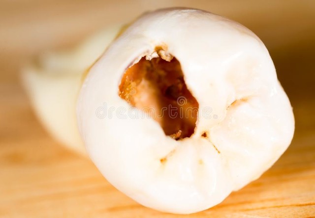 年底牙疼怎么办,春季牙疼是什么原因