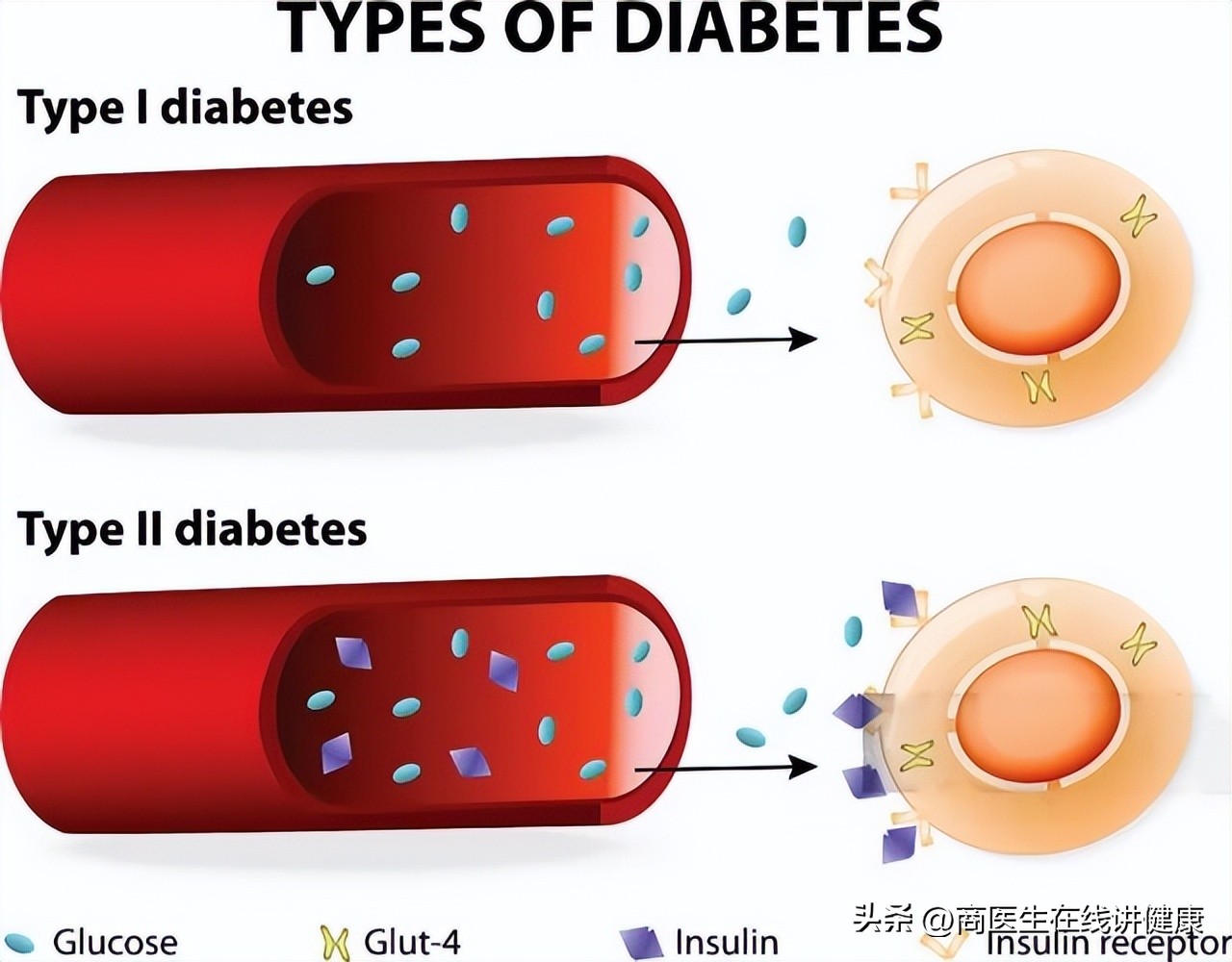 降糖药达格列净长期吃有什么害处,降糖药物达格列净有什么优势