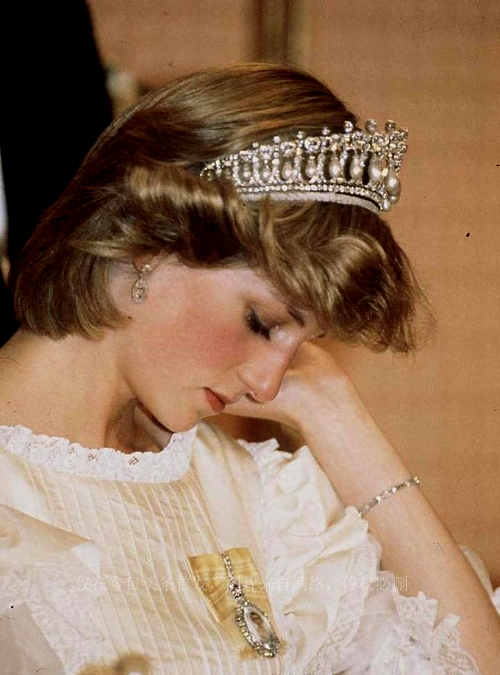 头皮扯出血也必须忍着，这才是真正的“欲戴王冠必承其重”！