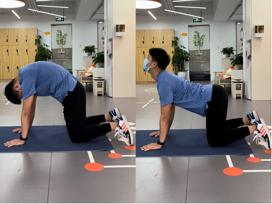 脊柱侧弯个案,冉冉高位截瘫