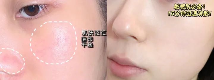 祛痘修护面膜测评红榜,好用的美白祛斑面膜测评