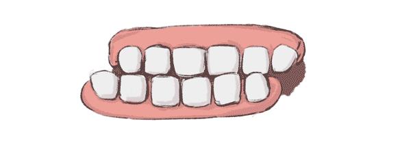 自己咬了一口会怎么样,一不小心咬到自己的伤口