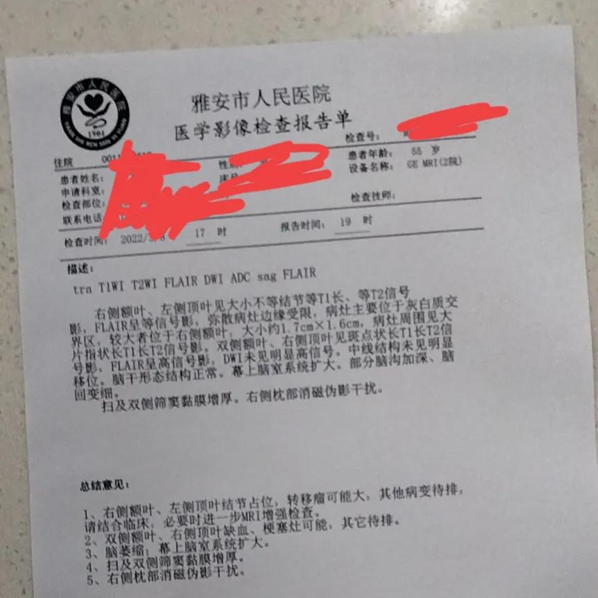 中国人寿防癌险包括哪些癌症,中国人寿癌症保险每年100元