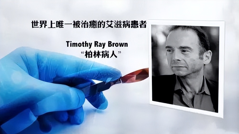 感染艾滋病毒后，你还能活多久？