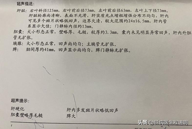 一位肝腹水患者的康复案例,我的肝硬化治疗经验分享