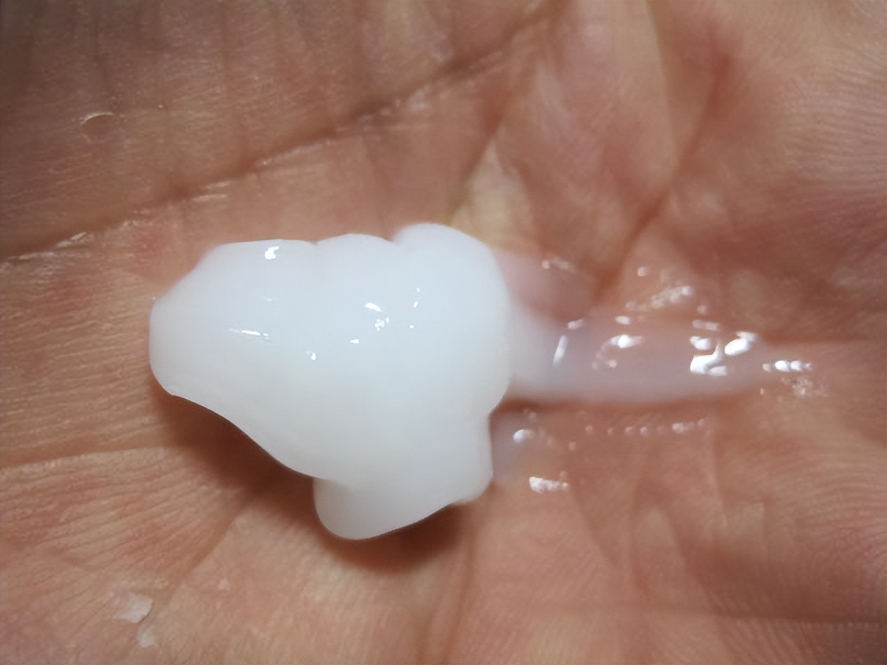 脸上起皮了是怎么回事,脸上起皮是什么原因怎么办