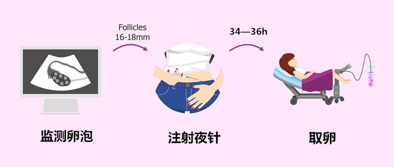 试管婴儿最全详细流程知乎,图文并茂记录试管婴儿全过程