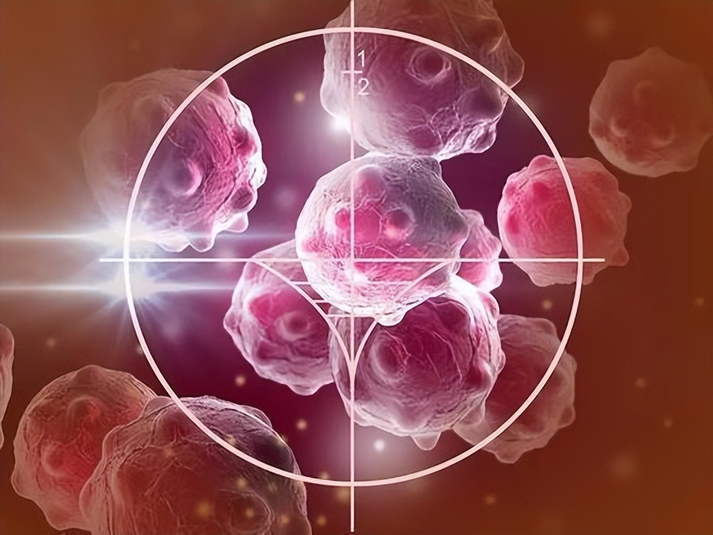 24岁小伙肠癌晚期治愈,小伙得了肠癌几年后自愈了