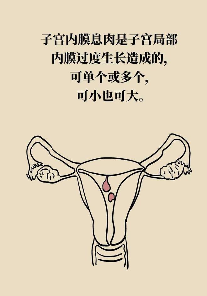 检查子宫息肉影响怀孕吗,检查出有子宫息肉对备孕有影响吗