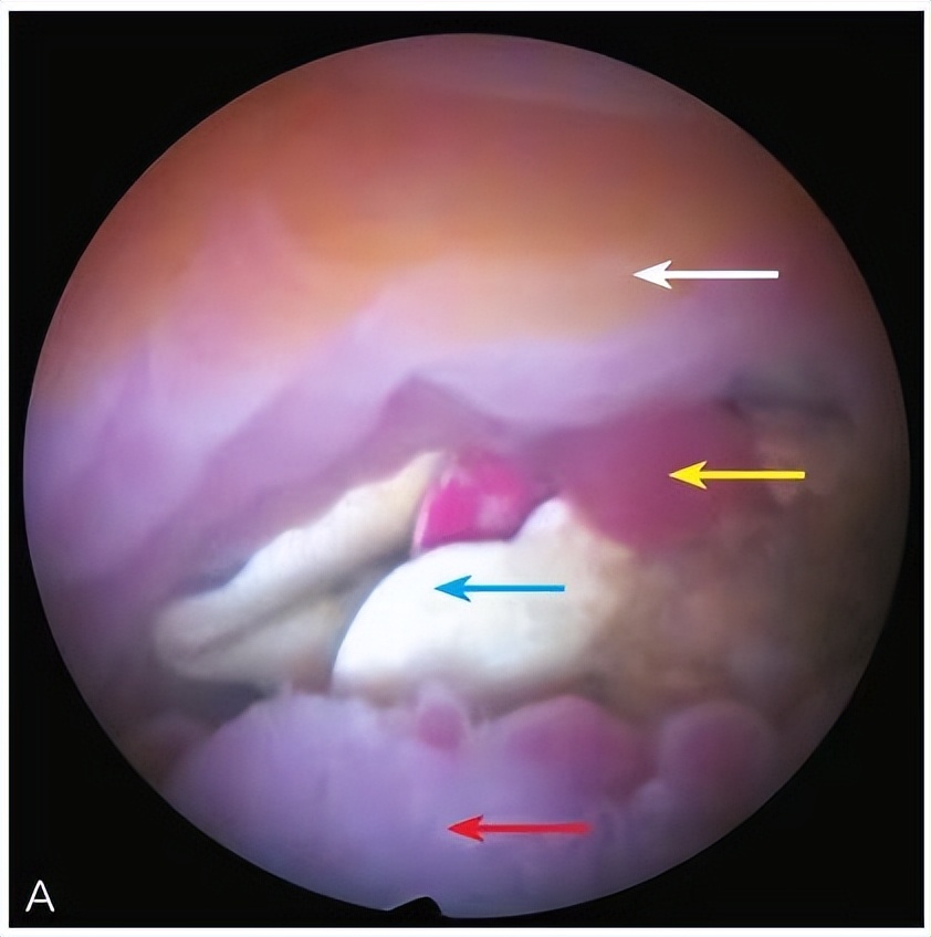 妇科医生5分钟小科普,门诊宫腔镜科普文章