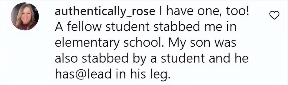 美国女子被橡皮子弹击中,女子手术取出戳20年铅笔芯